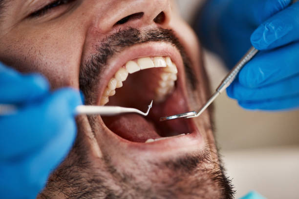 Best Emergency Root Canal Treatment in Houston, MO