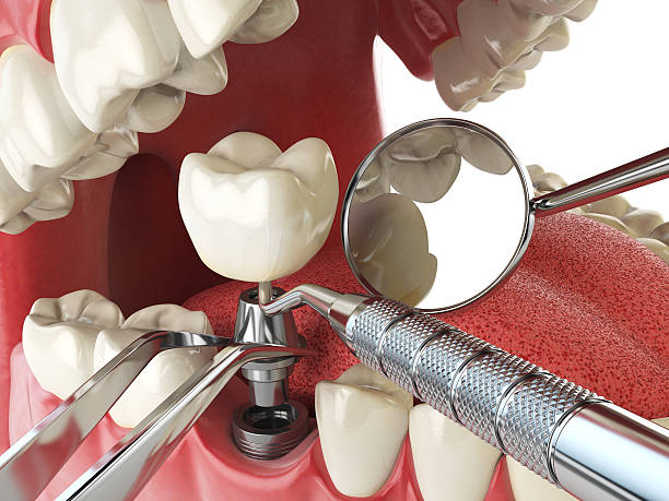 Best After-Hours Emergency Dentist in Houston, MO