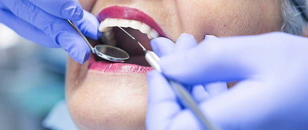 Best Emergency Wisdom Teeth Removal in Houston, MO