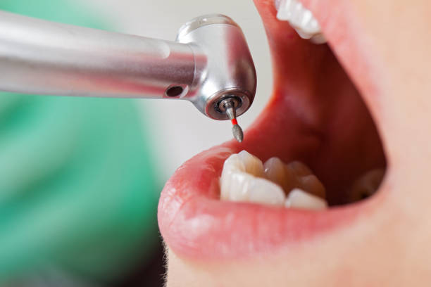 Best Emergency Treatment for Toothache in Houston, MO